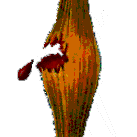 D&eacute;chirure