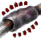 Tendinite